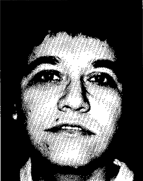 Historical frontal facial plate from cluster headache facies material