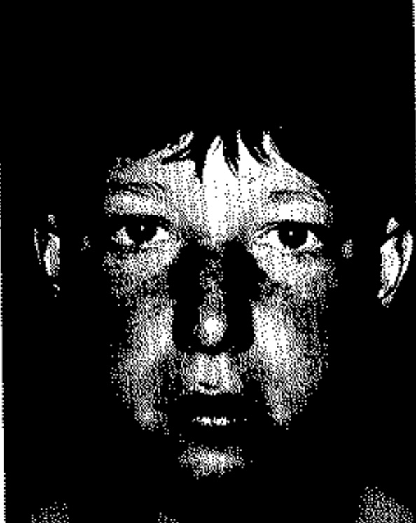 Historical facies plate 5 from cluster headache literature